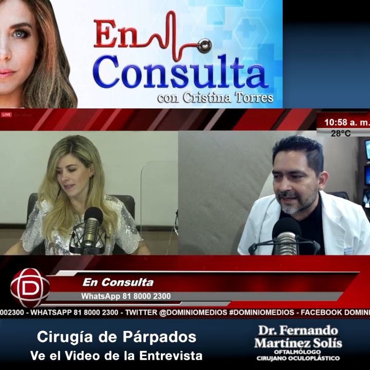 Entrevista en Radio sobre Blefaroplastia - 21 de mayo 2021