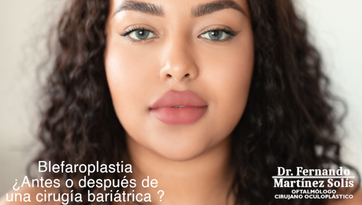 Blefaroplastia y Cirugía Bariátrica