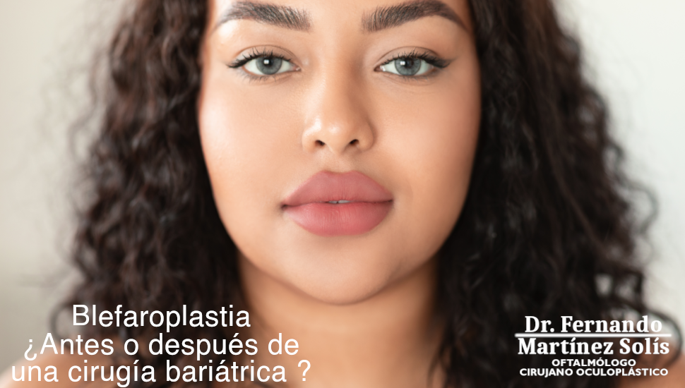 Blefaroplastia y Cirugía Bariátrica